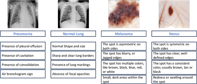 Figure 3 for Aligning Medical Images with General Knowledge from Large Language Models