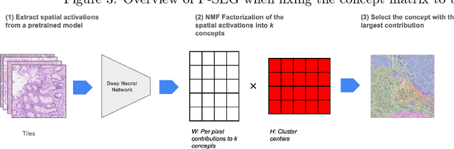 Figure 3 for Segmentation by Factorization: Unsupervised Semantic Segmentation for Pathology by Factorizing Foundation Model Features