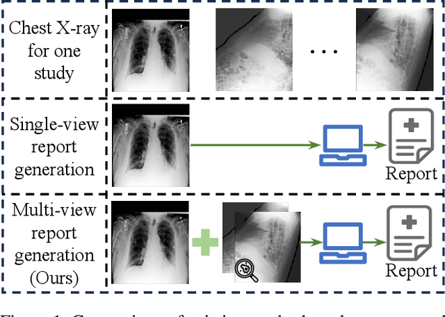 Figure 1 for MCL: Multi-view Enhanced Contrastive Learning for Chest X-ray Report Generation