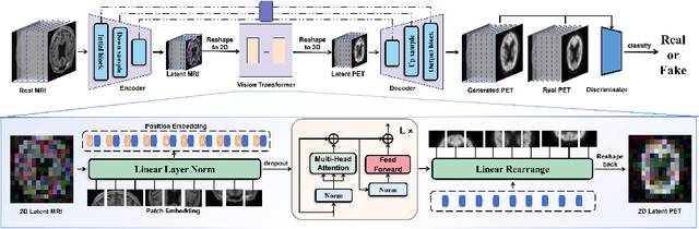 Figure 3 for GFE-Mamba: Mamba-based AD Multi-modal Progression Assessment via Generative Feature Extraction from MCI