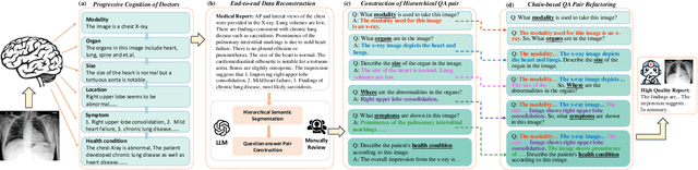 Figure 1 for MedThink: Inducing Medical Large-scale Visual Language Models to Hallucinate Less by Thinking More