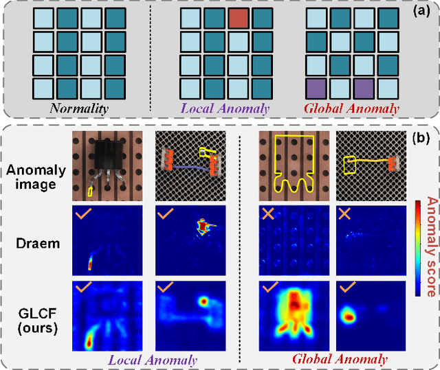 Figure 1 for Learning Global-Local Correspondence with Semantic Bottleneck for Logical Anomaly Detection