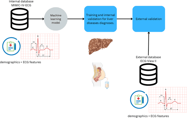 Figure 1 for Electrocardiogram-based diagnosis of liver diseases: an externally validated and explainable machine learning approach