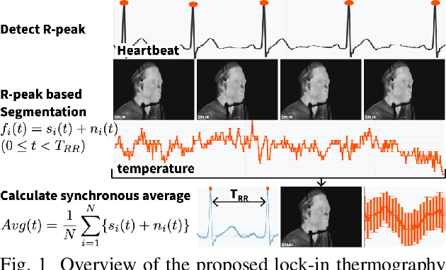 Figure 1 for Detecting $\sim$10 mK Face Temperature Change Based on Lock-in Thermography Referencing Heartbeat