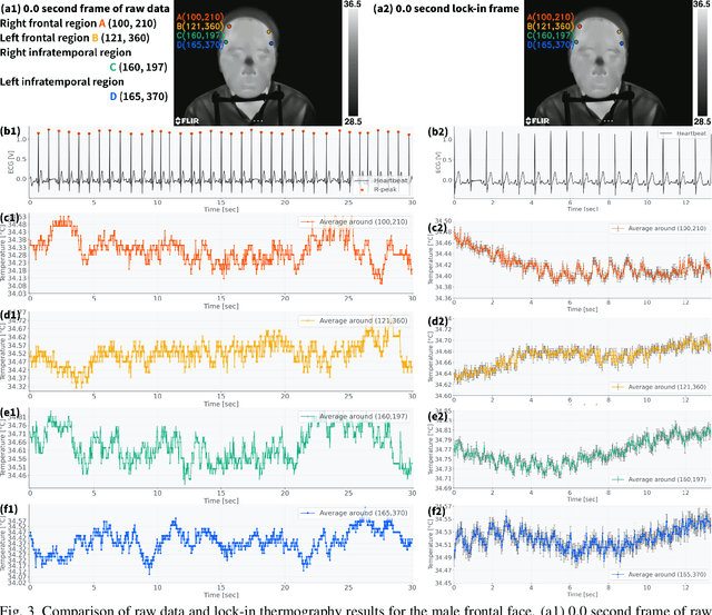 Figure 3 for Detecting $\sim$10 mK Face Temperature Change Based on Lock-in Thermography Referencing Heartbeat