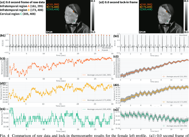 Figure 4 for Detecting $\sim$10 mK Face Temperature Change Based on Lock-in Thermography Referencing Heartbeat