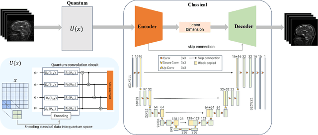 Figure 1 for Quantum Neural Network for Accelerated Magnetic Resonance Imaging