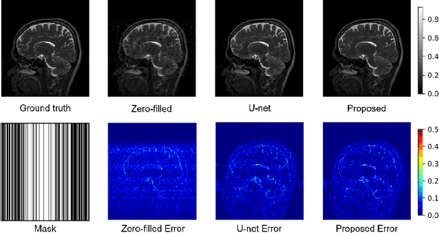 Figure 2 for Quantum Neural Network for Accelerated Magnetic Resonance Imaging