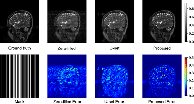 Figure 3 for Quantum Neural Network for Accelerated Magnetic Resonance Imaging