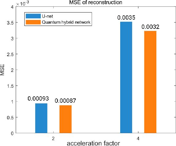 Figure 4 for Quantum Neural Network for Accelerated Magnetic Resonance Imaging