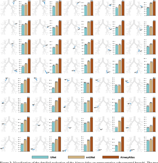 Figure 4 for A Digitalized Atlas for Pulmonary Airway