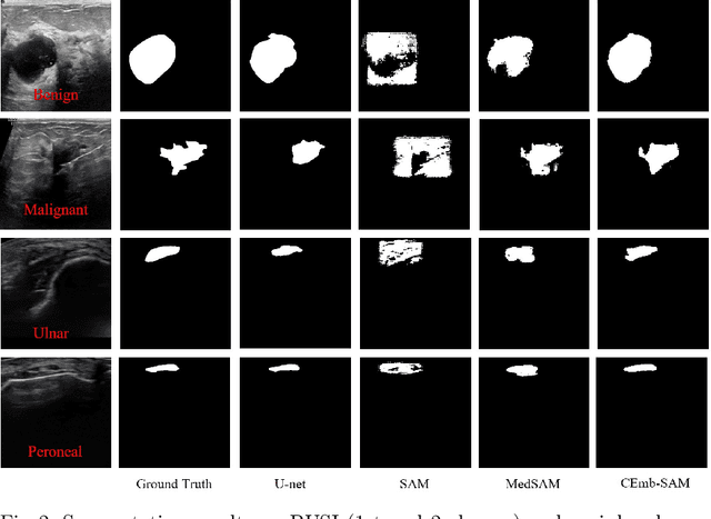 Figure 4 for CEmb-SAM: Segment Anything Model with Condition Embedding for Joint Learning from Heterogeneous Datasets