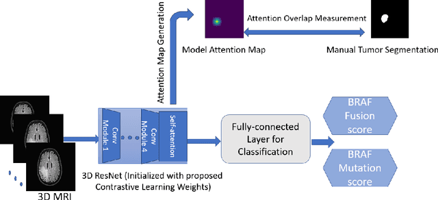 Figure 3 for Tumor Location-weighted MRI-Report Contrastive Learning: A Framework for Improving the Explainability of Pediatric Brain Tumor Diagnosis