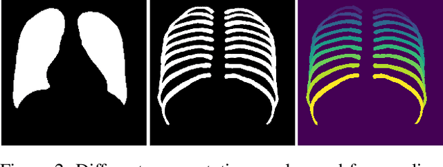 Figure 3 for Employing similarity to highlight differences: On the impact of anatomical assumptions in chest X-ray registration methods