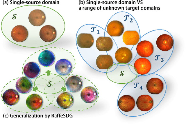 Figure 1 for RaffeSDG: Random Frequency Filtering enabled Single-source Domain Generalization for Medical Image Segmentation