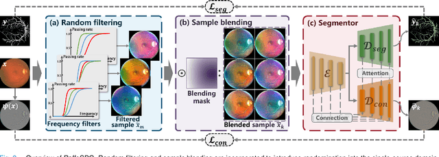 Figure 3 for RaffeSDG: Random Frequency Filtering enabled Single-source Domain Generalization for Medical Image Segmentation