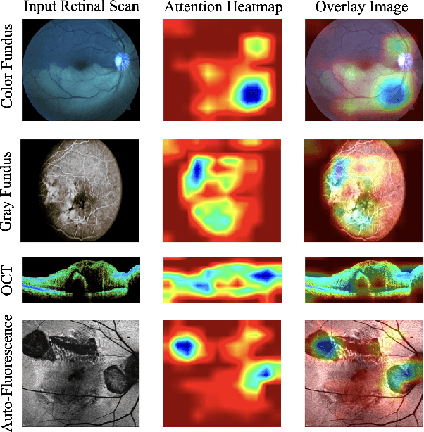 Figure 4 for M3T: Multi-Modal Medical Transformer to bridge Clinical Context with Visual Insights for Retinal Image Medical Description Generation