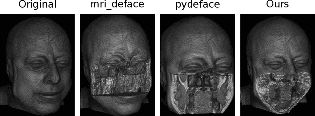 Figure 3 for De-Identification of Medical Imaging Data: A Comprehensive Tool for Ensuring Patient Privacy