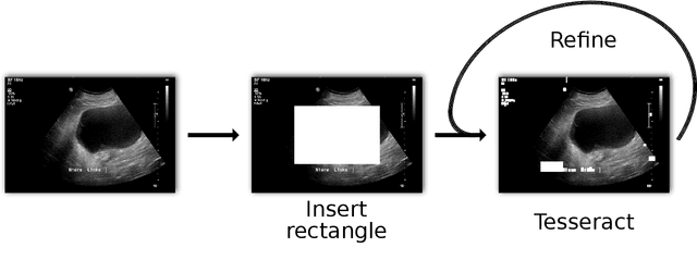 Figure 4 for De-Identification of Medical Imaging Data: A Comprehensive Tool for Ensuring Patient Privacy