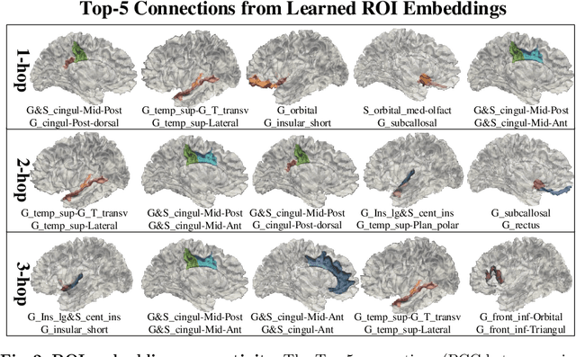 Figure 3 for Using Structural Similarity and Kolmogorov-Arnold Networks for Anatomical Embedding of 3-hinge Gyrus