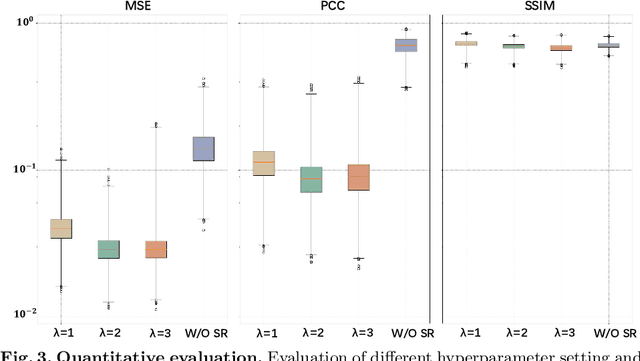 Figure 4 for Using Structural Similarity and Kolmogorov-Arnold Networks for Anatomical Embedding of 3-hinge Gyrus