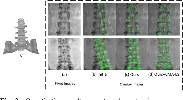 Figure 3 for Fully Differentiable Correlation-driven 2D/3D Registration for X-ray to CT Image Fusion