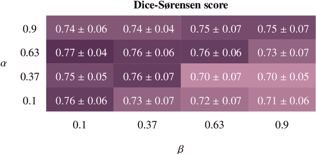 Figure 2 for Voxel-wise classification for porosity investigation of additive manufactured parts with 3D unsupervised and (deeply) supervised neural networks