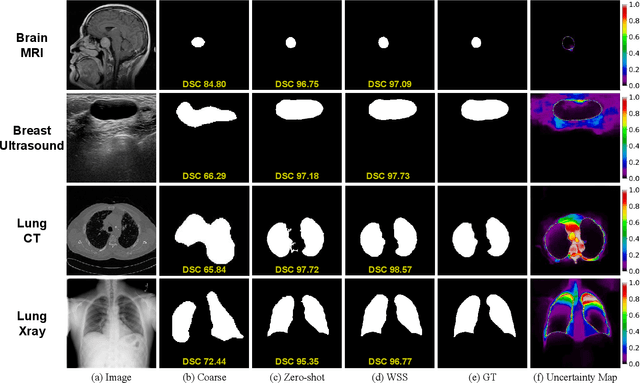 Figure 2 for MedCLIP-SAMv2: Towards Universal Text-Driven Medical Image Segmentation