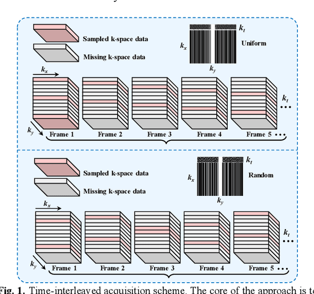 Figure 1 for Zero-shot Dynamic MRI Reconstruction with Global-to-local Diffusion Model