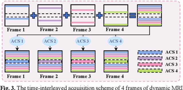 Figure 3 for Zero-shot Dynamic MRI Reconstruction with Global-to-local Diffusion Model