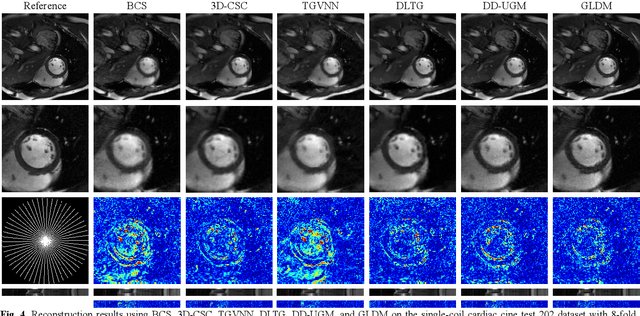 Figure 4 for Zero-shot Dynamic MRI Reconstruction with Global-to-local Diffusion Model