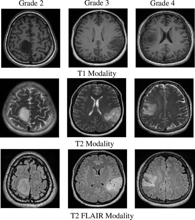 Figure 1 for Comparative Analysis of ImageNet Pre-Trained Deep Learning Models and DINOv2 in Medical Imaging Classification