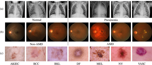 Figure 2 for Comparative Analysis of ImageNet Pre-Trained Deep Learning Models and DINOv2 in Medical Imaging Classification