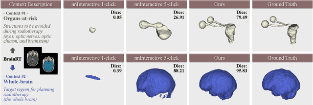 Figure 3 for Atlas is Your Perfect Context: One-Shot Customization for Generalizable Foundational Medical Image Segmentation