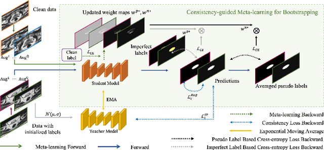 Figure 1 for Consistency-guided Meta-Learning for Bootstrapping Semi-Supervised Medical Image Segmentation