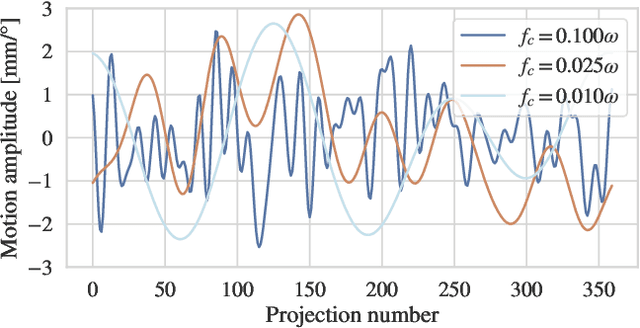 Figure 2 for On the Influence of Smoothness Constraints in Computed Tomography Motion Compensation