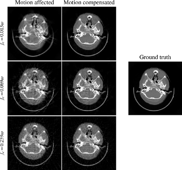 Figure 4 for On the Influence of Smoothness Constraints in Computed Tomography Motion Compensation