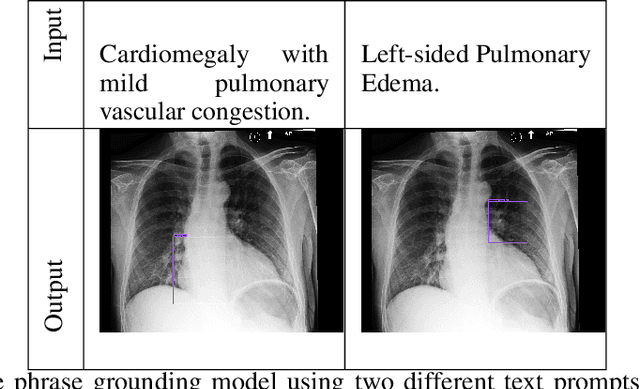 Figure 2 for VICCA: Visual Interpretation and Comprehension of Chest X-ray Anomalies in Generated Report Without Human Feedback