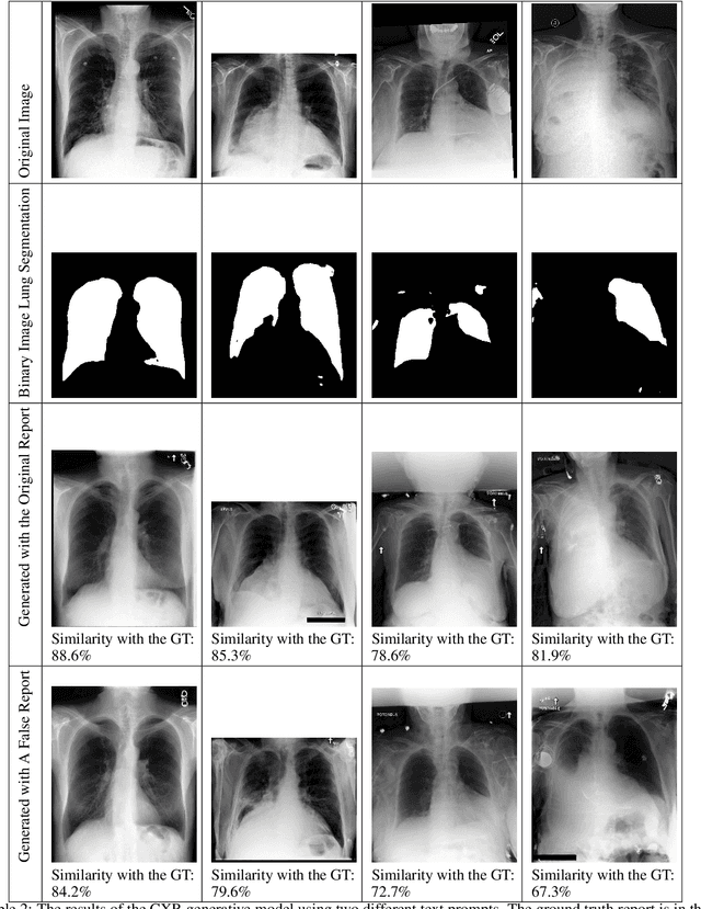 Figure 4 for VICCA: Visual Interpretation and Comprehension of Chest X-ray Anomalies in Generated Report Without Human Feedback