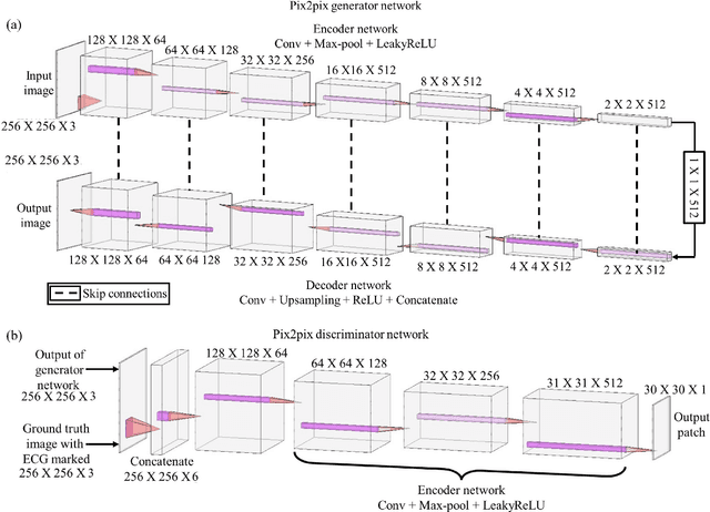 Figure 2 for Auto Lead Extraction and Digitization of ECG Paper Records using cGAN