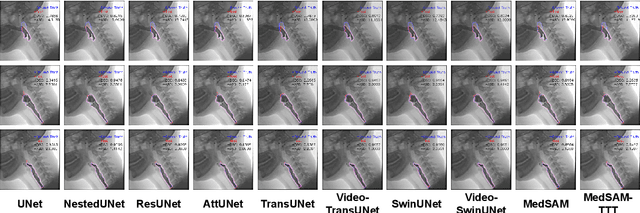 Figure 2 for Tuning Vision Foundation Model via Test-Time Prompt-Guided Training for VFSS Segmentations