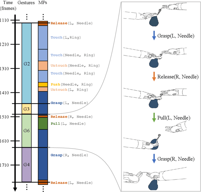 Figure 1 for Towards Interpretable Motion-level Skill Assessment in Robotic Surgery