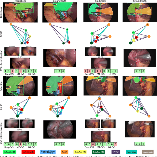 Figure 3 for Latent Graph Representations for Critical View of Safety Assessment