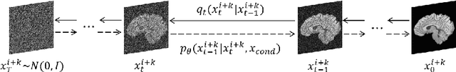 Figure 3 for Arbitrary Reduction of MRI Inter-slice Spacing Using Hierarchical Feature Conditional Diffusion