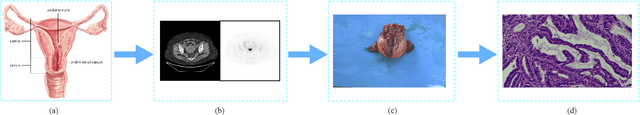 Figure 1 for ECPC-IDS:A benchmark endometrail cancer PET/CT image dataset for evaluation of semantic segmentation and detection of hypermetabolic regions