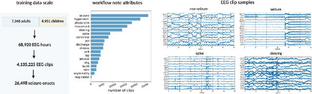 Figure 3 for Towards trustworthy seizure onset detection using workflow notes