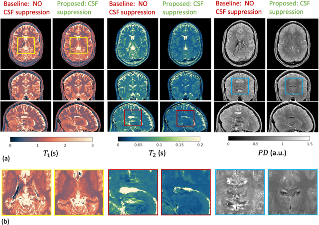 Figure 3 for Time-efficient, high-resolution 3T whole-brain relaxometry using Cartesian 3D MR-STAT with CSF suppression