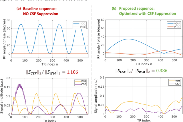 Figure 1 for Time-efficient, high-resolution 3T whole-brain relaxometry using Cartesian 3D MR-STAT with CSF suppression