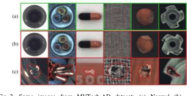 Figure 2 for Unsupervised Anomaly Detection with an Enhanced Teacher for Student-Teacher Feature Pyramid Matching