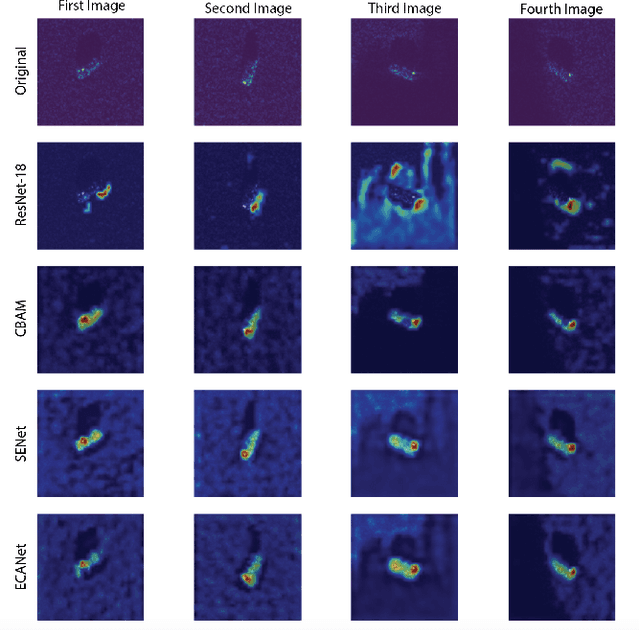 Figure 2 for Studying the Effects of Self-Attention on SAR Automatic Target Recognition